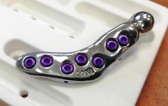 CT inspection advances production of bespoke metal additively manufactured medical implants CT inspection advances production of bespoke metal additively manufactured medical implants