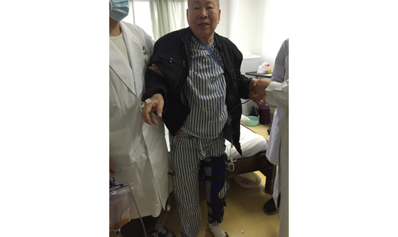 Chinese hospital 3D prints tantalum knee joint