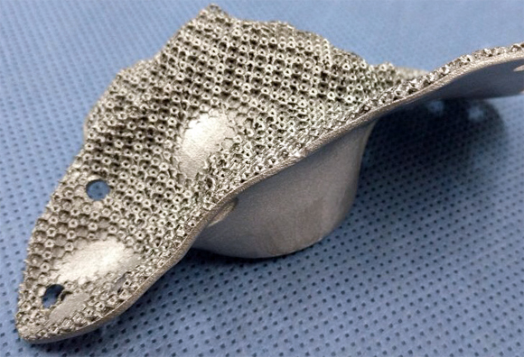 Link3D enables Argentinian orthopaedic implant maker’s first step into metal 3D printing