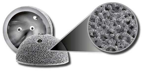 GE Additive launches Orthopaedic Validation Consultancy for metal 3D printed medical devices GE Additive launches Orthopaedic Validation Consultancy for metal 3D printed medical devices