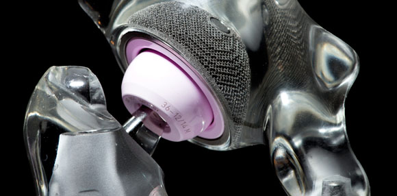 Celebrating ten years of metal additively manufactured hip cups