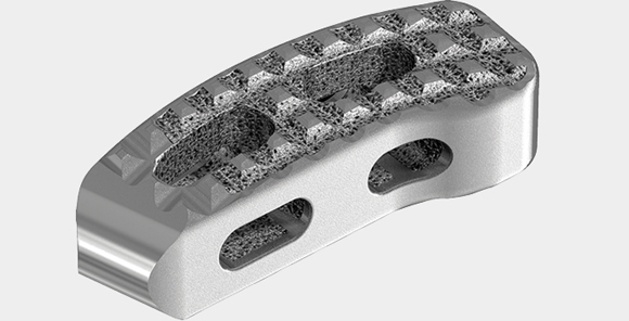 Stryker receives FDA clearance for metal 3D printed lumbar cage Stryker receives FDA clearance for metal 3D printed lumbar cage