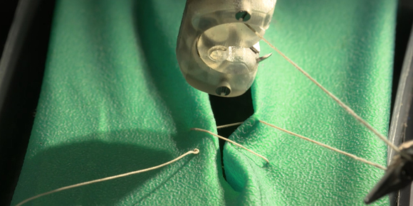 Metal Additive Manufacturing enables development of automated suturing devices Metal Additive Manufacturing enables development of automated suturing devices