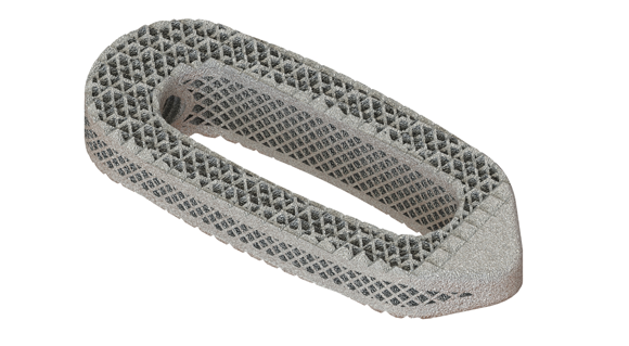 Osseus receives FDA approval for five new additively manufactured titanium spine implants
