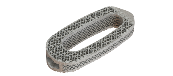 Osseus's AM titanium spinal implant sees first patient use