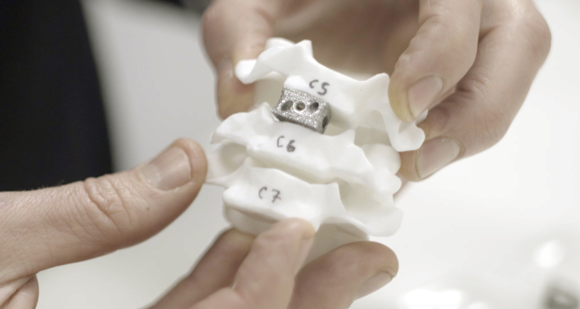 Renishaw collaboration demonstrates capabilities of AM for spinal implants