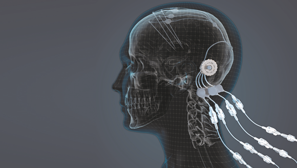 Metal Additive Manufacturing enables device with potential to cure Parkinson's disease