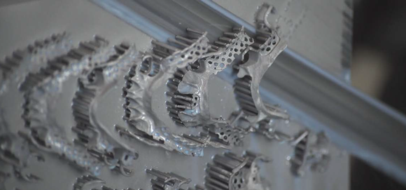 Renishaw enables metal Additive Manufacturing of Removable Partial Dentures