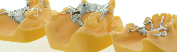 Renishaw enables metal Additive Manufacturing of Removable Partial Dentures