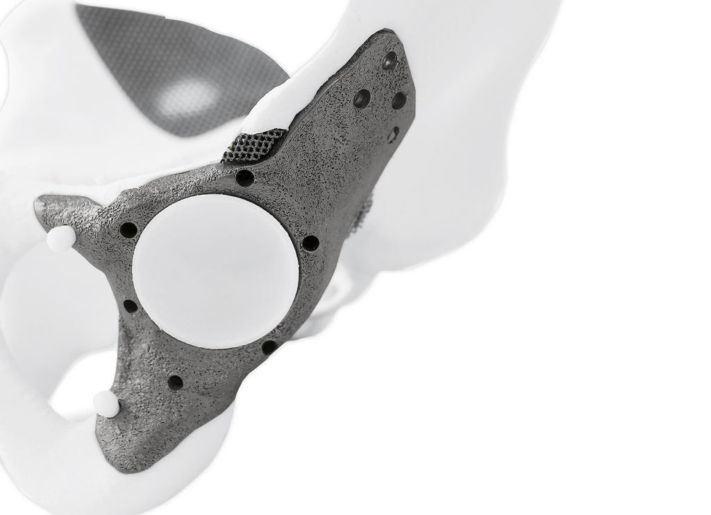 FIT AG: Laying the foundations for high-volume metal Additive Manufacturing