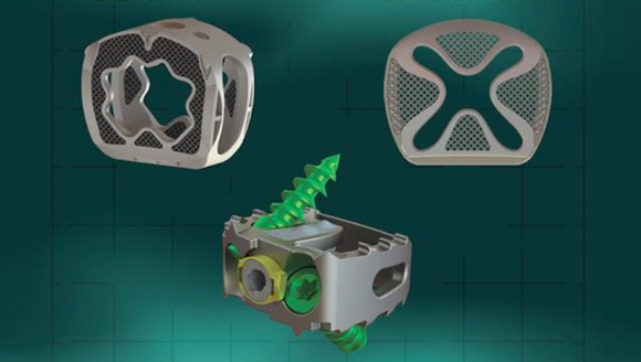 The SureMAX (top left), SureMAX-X (top right) and SureMAX-SA (bottom) cervical spacers from Additive Implants (Courtesy Additive Implants)