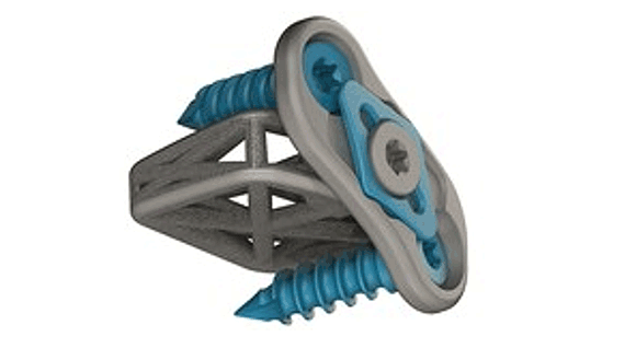 4WEB Medical’s Cervical Spine Truss System Integrated Plating Solution has obtained 510K clearance (Courtersy 4WEB Medical)