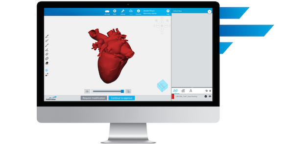 Materialise’s Mimics Flow Case management is expected to increase the value of point-of-care Additive Manufacturing in the medical sector (Courtesy Materialise)