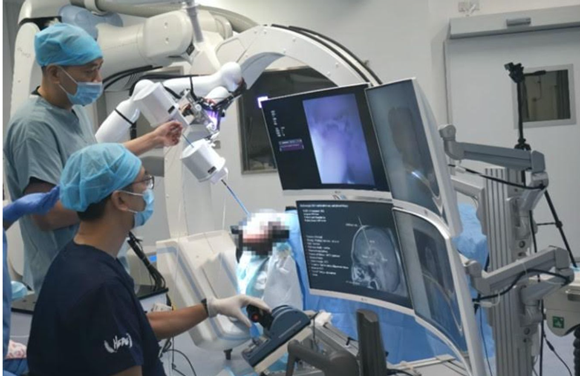 MicroNeuro is a flexible robotic system for minimally invasive brain surgery (Courtesy BLT)