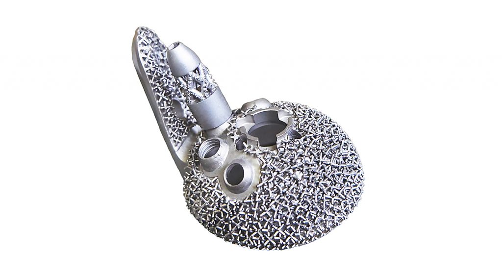 Fig. 7 Example of an additively manufactured Ti-6Al-4V medical implant part, manufactured to an open porous surface structure for cementless fixation in the bone. Surface oxides, alpha case, and contaminants formed inside the porous structure during manufacturing can be difficult to remove and can affect fatigue properties as well as bone ingrowth (Courtesy Quintus Technologies)