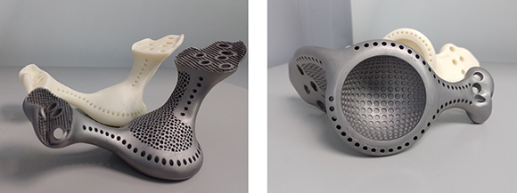 Implants additively manufactured by Bioprotece with the EP-M260 (Courtesy Eplus3D)