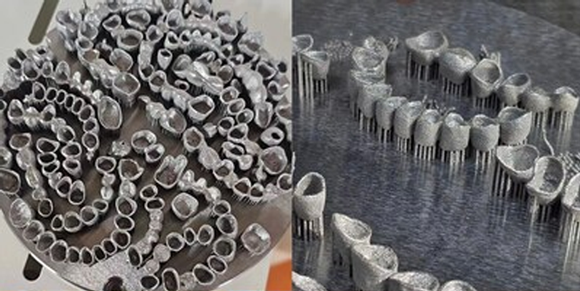 Draghici Dental will use the metal AM machines for RPD frameworks, crowns and bridges (Courtesy Draghici Dental/Chamlion)