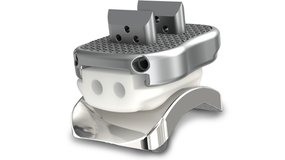 The Kinos Range of ankle implants includes polyethylene and additively manufactured cobalt chrome implants (Courtesy restor3d)