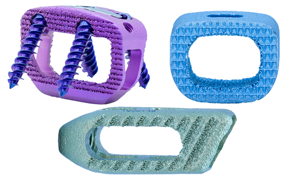 Spinal Implants by Acuity Surgical. Clockwise - Ventris ALIF, Stand-Alone Anterior Lumbar System; Stabilis NF, Non-Fixated Anterior Cervical System and the Tera-O (Oblique TLIF), Posterior Lumbar System (Courtesy Acuity Surgical)