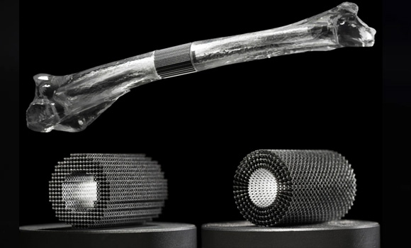 Successfully manufactured demonstrator for the treatment of a critical tubular bone defect (Courtesy RWTH DAP)