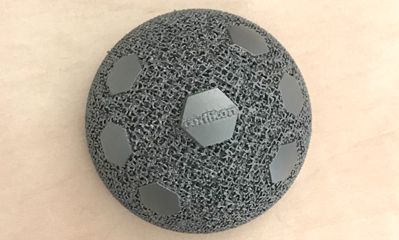 Additively manufactured titanium hip implant (Courtesy Oerlikon Metco)