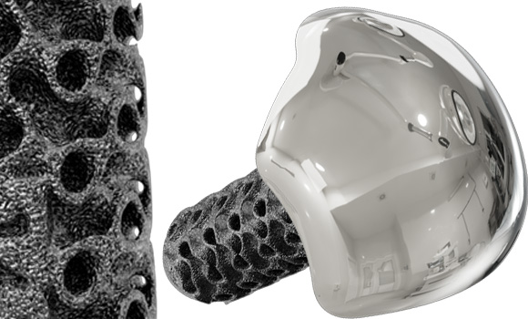 Partners Group has invested $65 million in restor3d, a provider of patient-specific musculoskeletal implants (Courtesy restor3d)