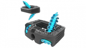 Nexxt Spine's latest additively manufactured spinal implant receives FDA clearance