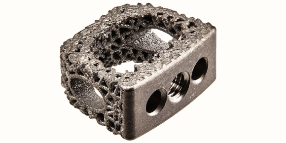 Ulrich Medical USA’s additively manufactured Flux-C interbody device has received FDA clearance (Courtesy Ulrich Medical USA)