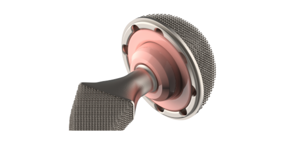 The TrabCup hip prosthesis is additively manufactured from titanium, offering high compatibility, strength and low friction (Courtesy TraBTech)