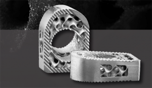 Restor3d use Additive Manufacturing to produce medical solutions such as the TIDAL subtalar wedge system shown here (Courtesy Restor3d)
