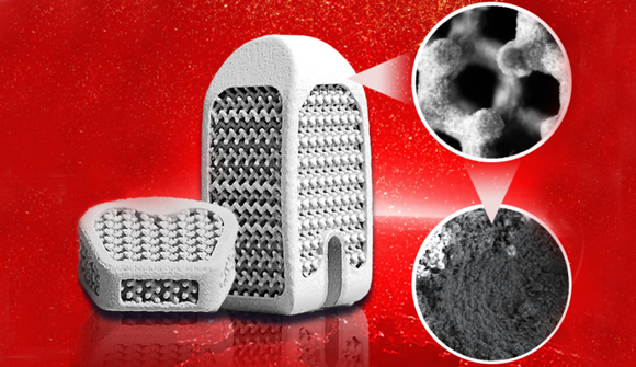 The Hydroxyapatite-coated porous titanium alloy interbody fusion device developed by Wedo, additively manufactured by BLT. The picture shows the truss + microporous structure and HA coating morphology under electron microscope (Courtesy BLT/Wedo)